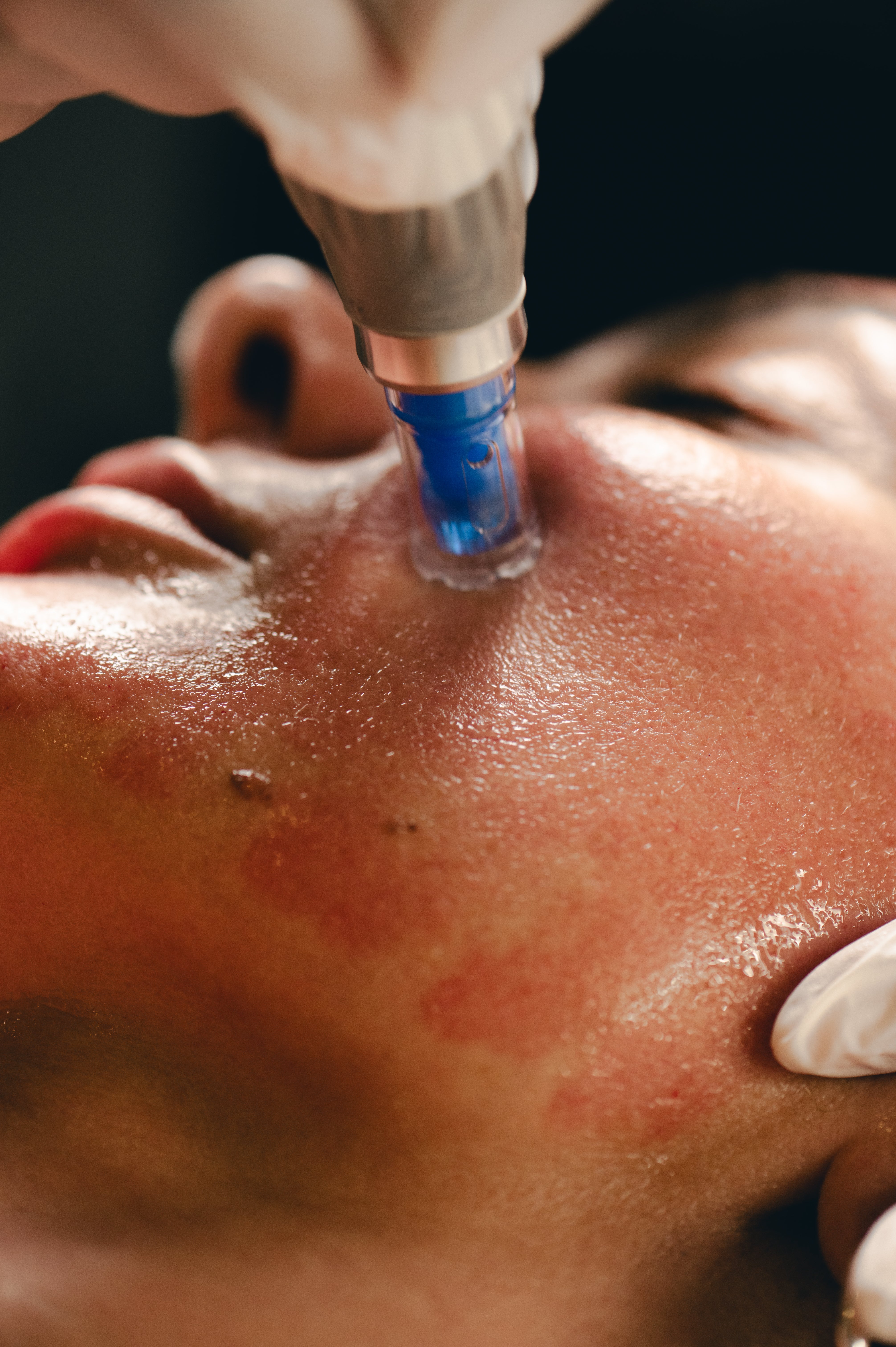 Silkclinic